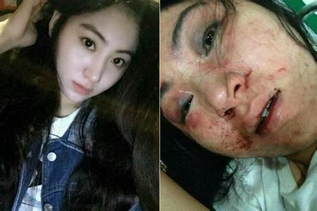 酒吧女歌手拒陪酒 遭老板娘毒打3小时