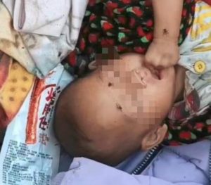 网传湖南一女婴住垃圾堆脸上苍蝇乱飞 县妇联：已采取帮扶措施