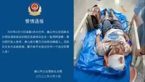 严惩唐山打人者