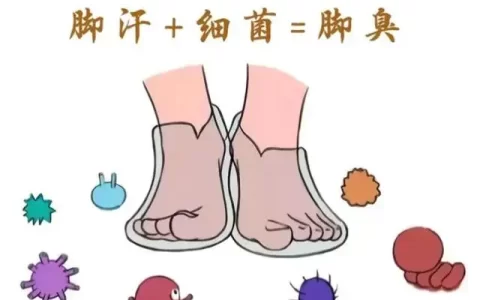 如何治疗脚臭、脚汗